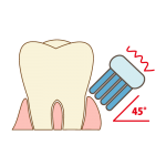 歯の表面を磨くのではなく、歯間を磨いてください。