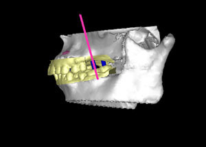 山形歯医者こだわり歯科医が語る本音の歯科講座-3D